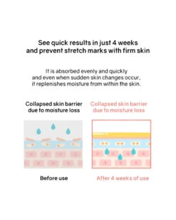 Botanical Therapy Stretch Cream -Motherswork Store 5 800x d8497b26 b071 4a1f bc60 baff66b4ce0e