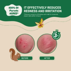 Pigeon Natural Botanical Baby Diaper Cream 50ML -Motherswork Store 5 9ef70d1d 4244 44c0 9f8f 4adbf7a1454e