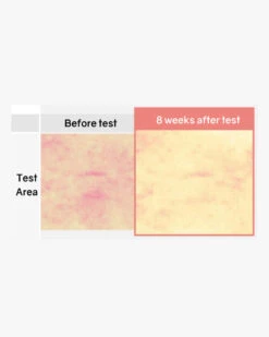 Botanical Therapy Stretch Cream -Motherswork Store 7 800x 52daabe1 4632 4d80 8eda 8df4171fa432